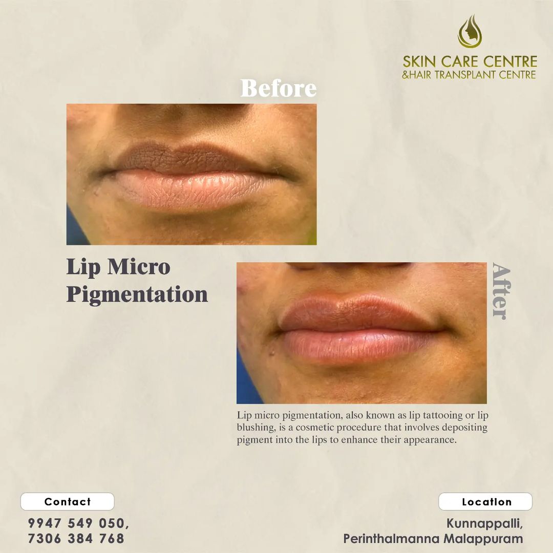Skin care clinic in Perinthalmanna