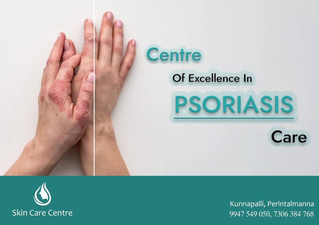 Skin care clinic in Perinthalmanna