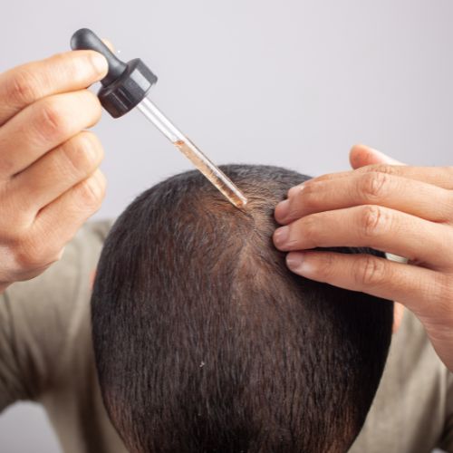 Hair Loss Treatment in Perinthalmanna