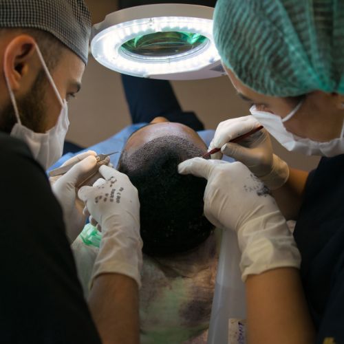 Hair Loss Treatment in Perinthalmanna