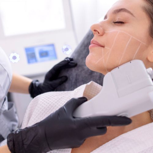 Best Hifu Treatment in Malappuram