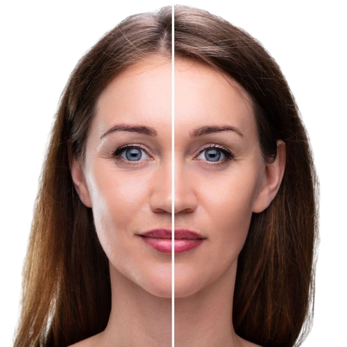 Best Hifu Treatment in Malappuram