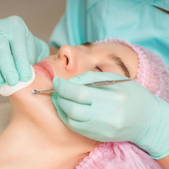 Hydra Facial in Perinthalmanna