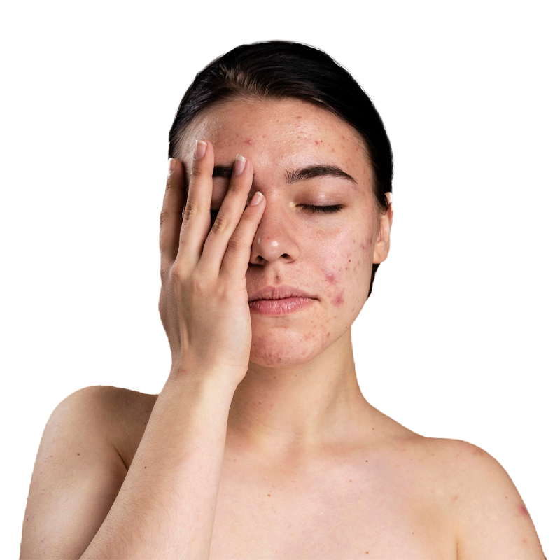 Skin care clinic in Perinthalmanna
