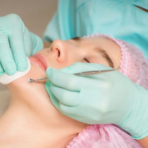 Hydra Facial in Perinthalmanna
